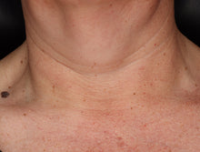 Load image into Gallery viewer, ZO Neck Complex
