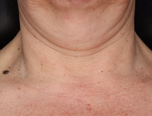 Load image into Gallery viewer, ZO Neck Complex
